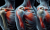 Acupuncture Techniques for Effective Relief of Frozen Shoulder