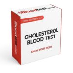 Cholesterol Blood Test Services Available in Manchester